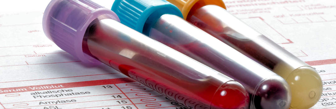 Three blood vials in blood test form